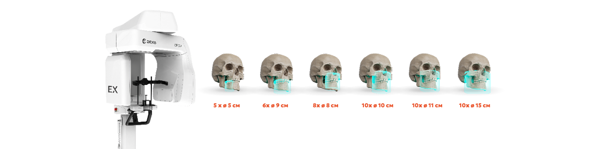 2026_07_28_dexis_scanning_zones_banners_1200x300_op_3d_ex